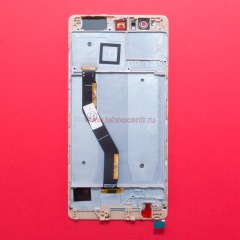 Huawei P9 Plus золотой с рамкой фото 2